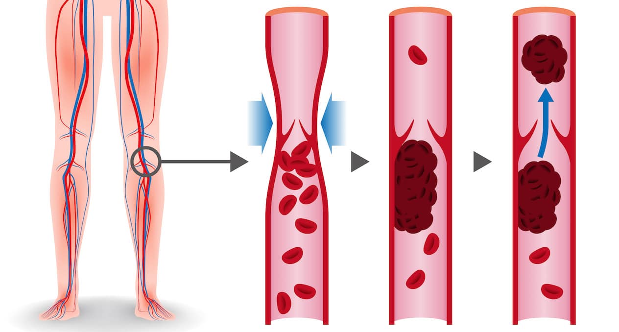 Diagram of blood vessels